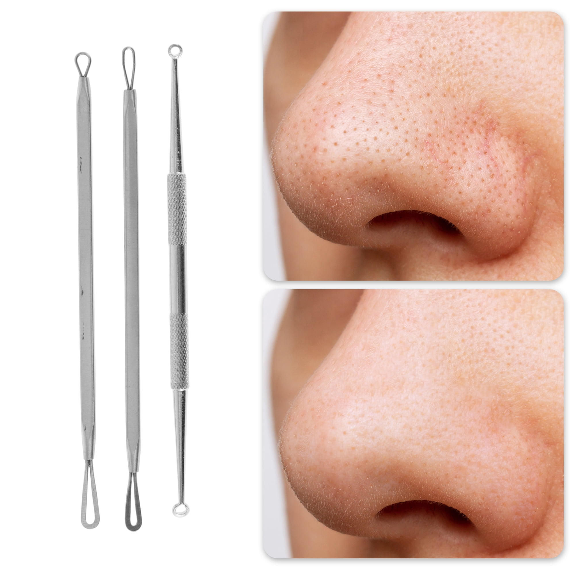 Professional Pimple Extractor  - Beauty & Makeup Katia Di Paola review and price